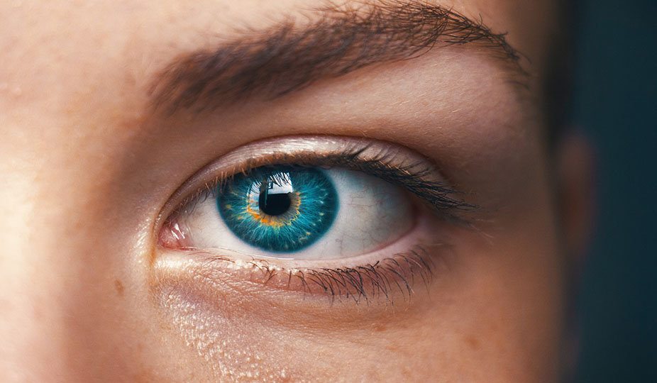 Mengenal Raccoon Eye, Kondisi Lebam di Sekitar Mata